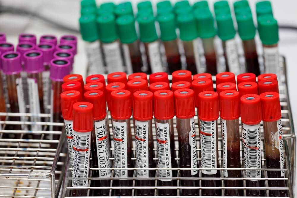 Optimizing Label Testing: 3 Key Laboratory Tips